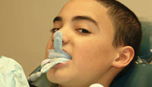 Fluoride Treatment at Dr. Gogia’s Super Specialty Dental Care Centre for stronger teeth and cavity prevention