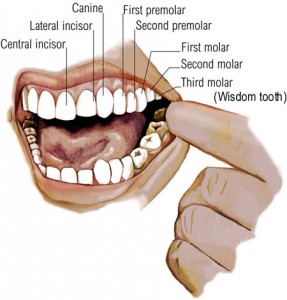 wisdom-teeth Safe and painless wisdom tooth extraction at Dr. Gogia’s Super Specialty Dental Care Centre in Rohtak for healthy and stress-free smiles.