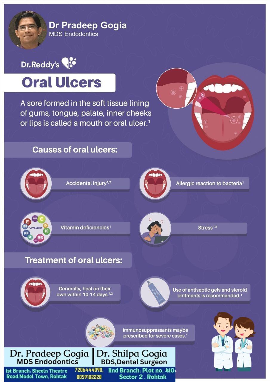 Oral ulcer on inner cheek causing discomfort