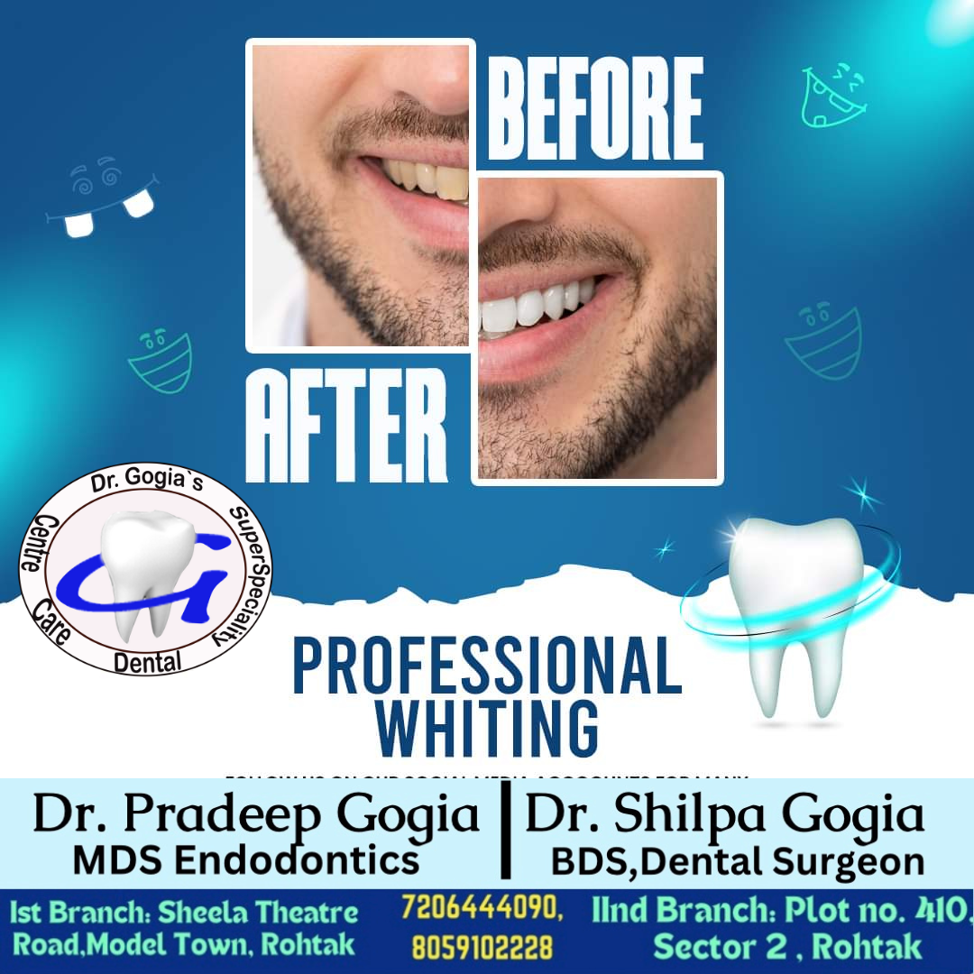 Teeth Whitening treatment at Dr. Gogia’s Super Specialty Dental Care Centre in Rohtak for a brighter and confident smile