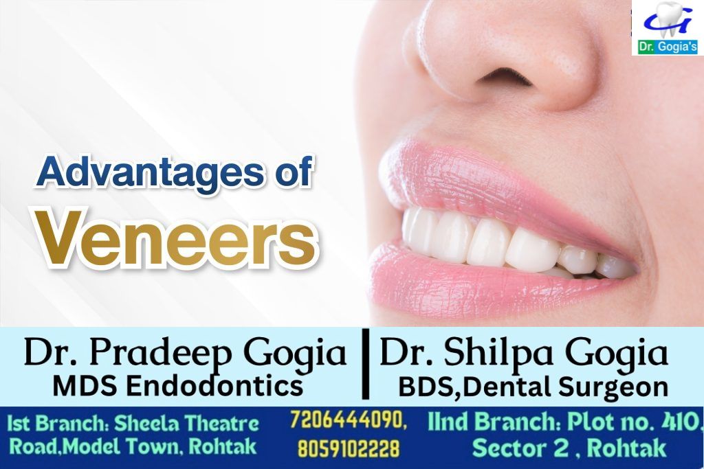 Advantages of Veneers in cosmetic dentistry treatment