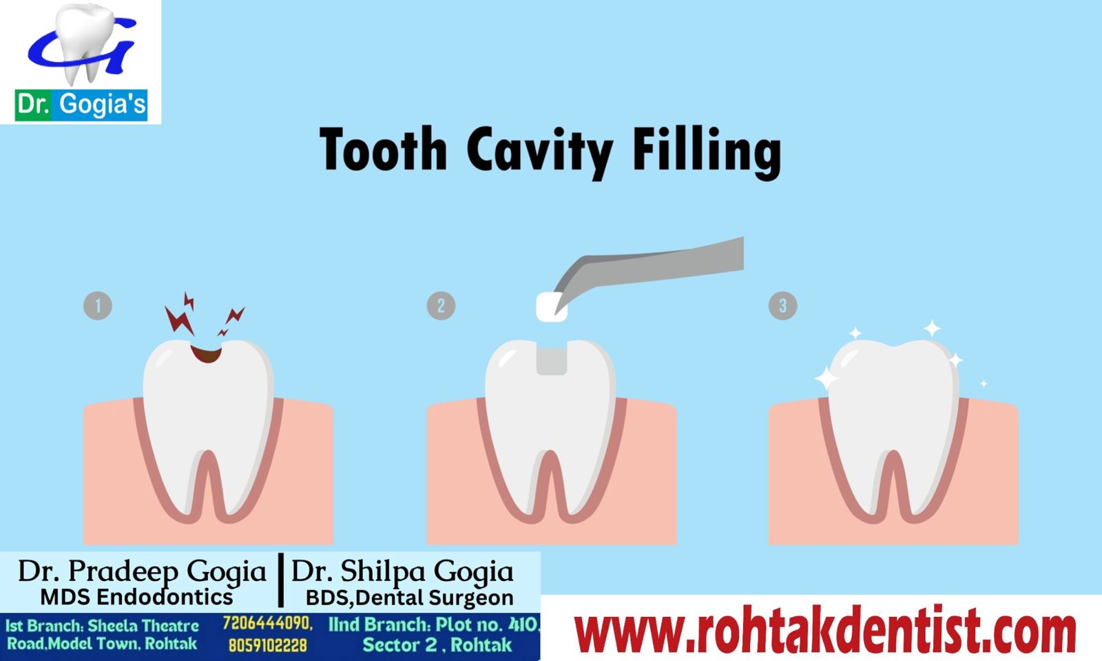 Patient receiving professional tooth cavity filling at Dr. Gogia's Super Specialty Dental Care Centre, Rohtak