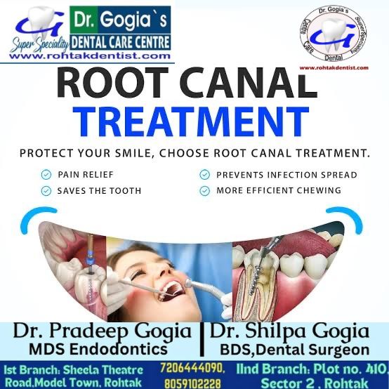 Root Canal Treatment procedure to save natural teeth in Rohtak