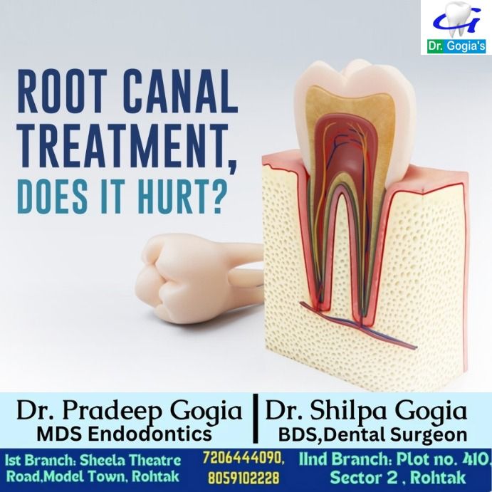 Root Canal Treatment Does It Hurt explained at Dr. Gogia’s Super Specialty Dental Care Centre