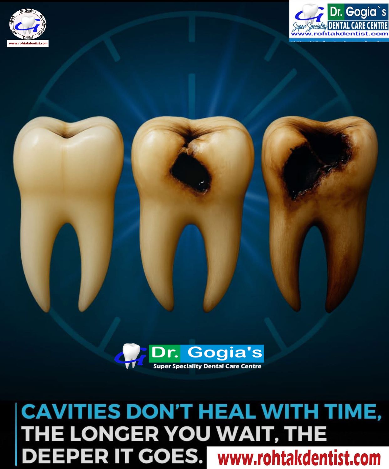 Act Fast with Cavity Treatment – Protect Your Smile Today