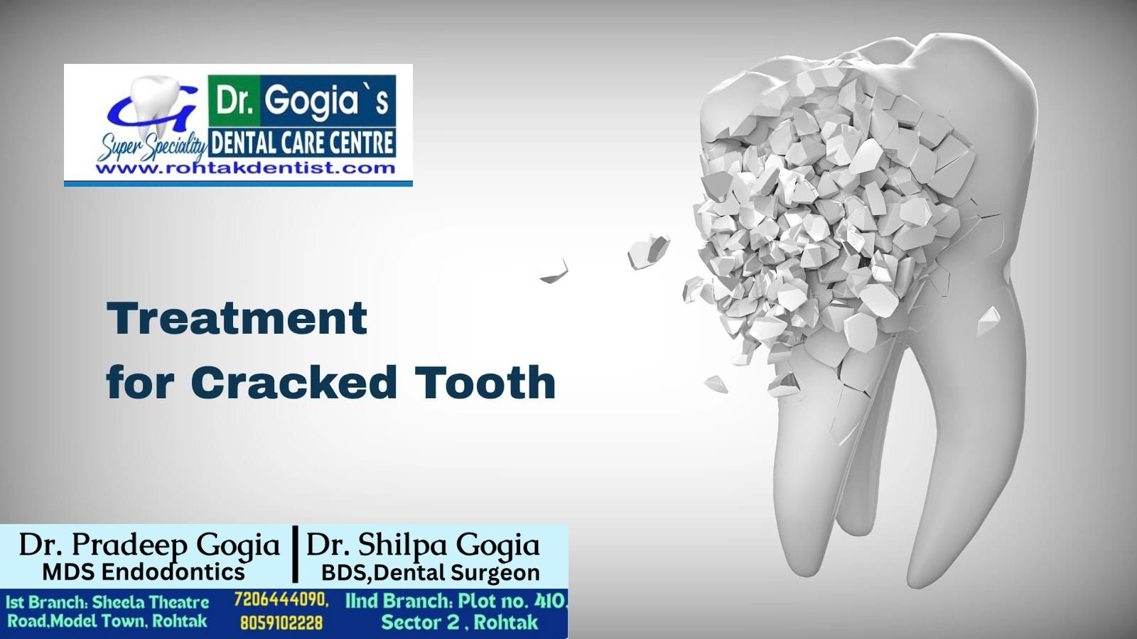 Cracked tooth treatment at Dr. Gogia’s Super Specialty Dental Care Centre in Rohtak