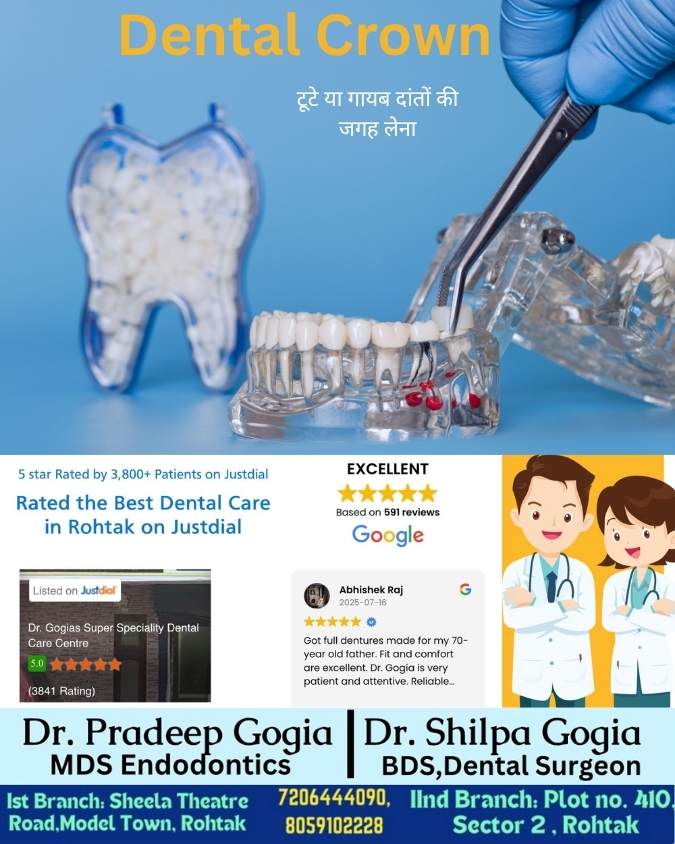 Best Dental Crowns: Strengthen & Beautify Teeth