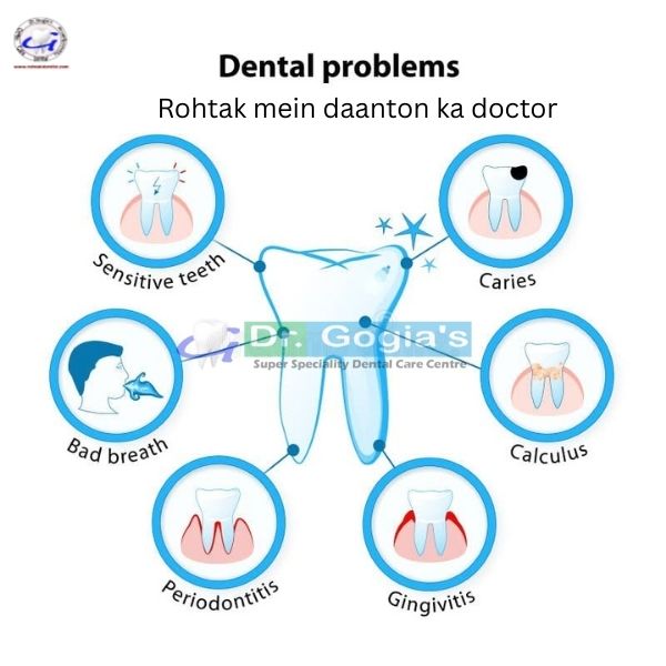 Rohtak dentist treating dental problems - Dr. Gogia Dental Care Rohtak dentist – Dental Problems Treatment