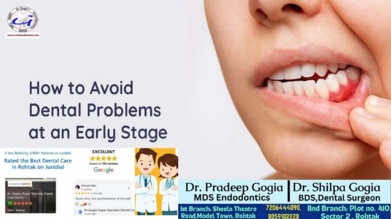 Early Dental Care Guide: Prevent Cavities and Gum Issues
