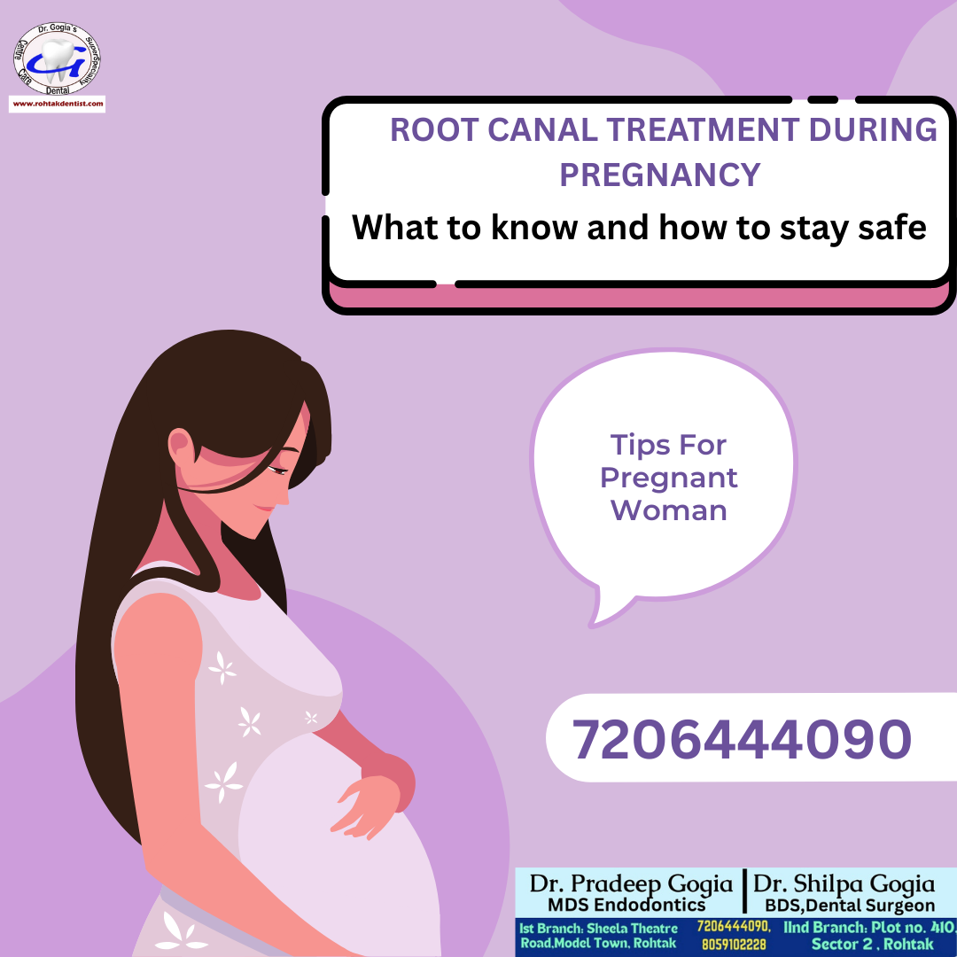 Root Canal in Pregnancy for safe and healthy dental care