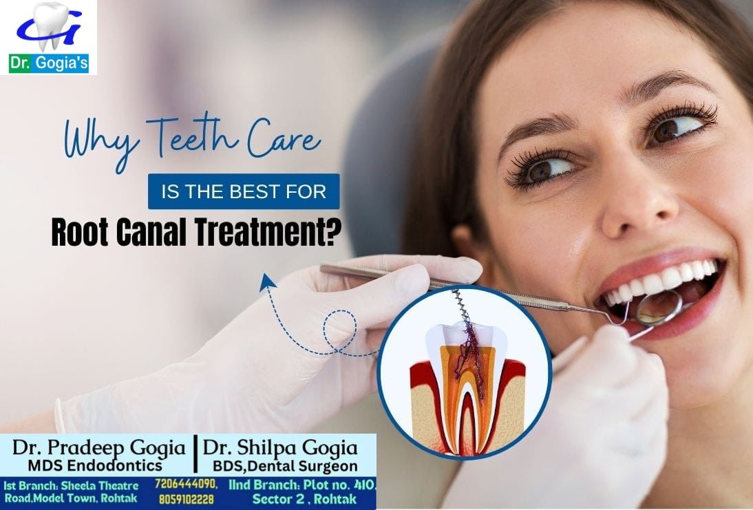 Root Canal Treatment in Rohtak – painless RCT to save infected tooth