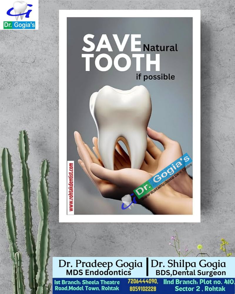 Save Your Natural Tooth at Dr. Gogia's Dental Clinic, Rohtak