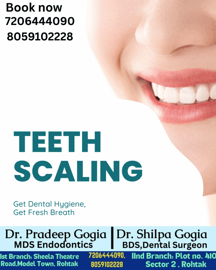Professional Teeth Scaling at Dr. Gogia’s Super Specialty Dental Care Centre in Rohtak – safe, painless, and effective for plaque and tartar removal.