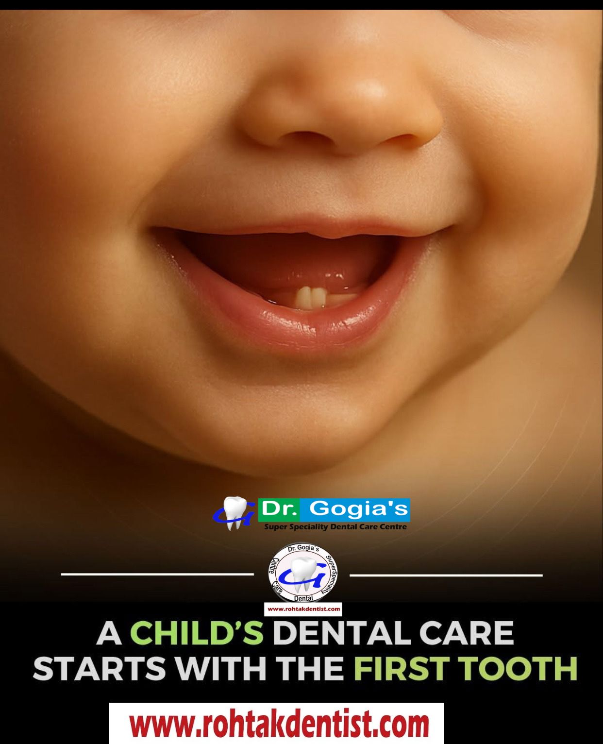 How to Take Care of Your Child’s First Tooth Properly