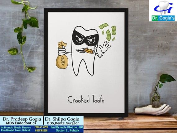 Crooked Tooth treatment and care at Dr. Gogia's Dental Clinic, Rohtak