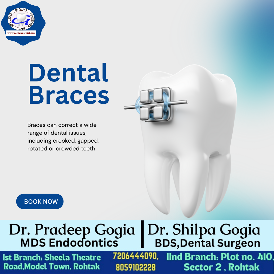 Dental braces treatment for teeth straightening at Dr. Gogia’s Clinic in Rohtak