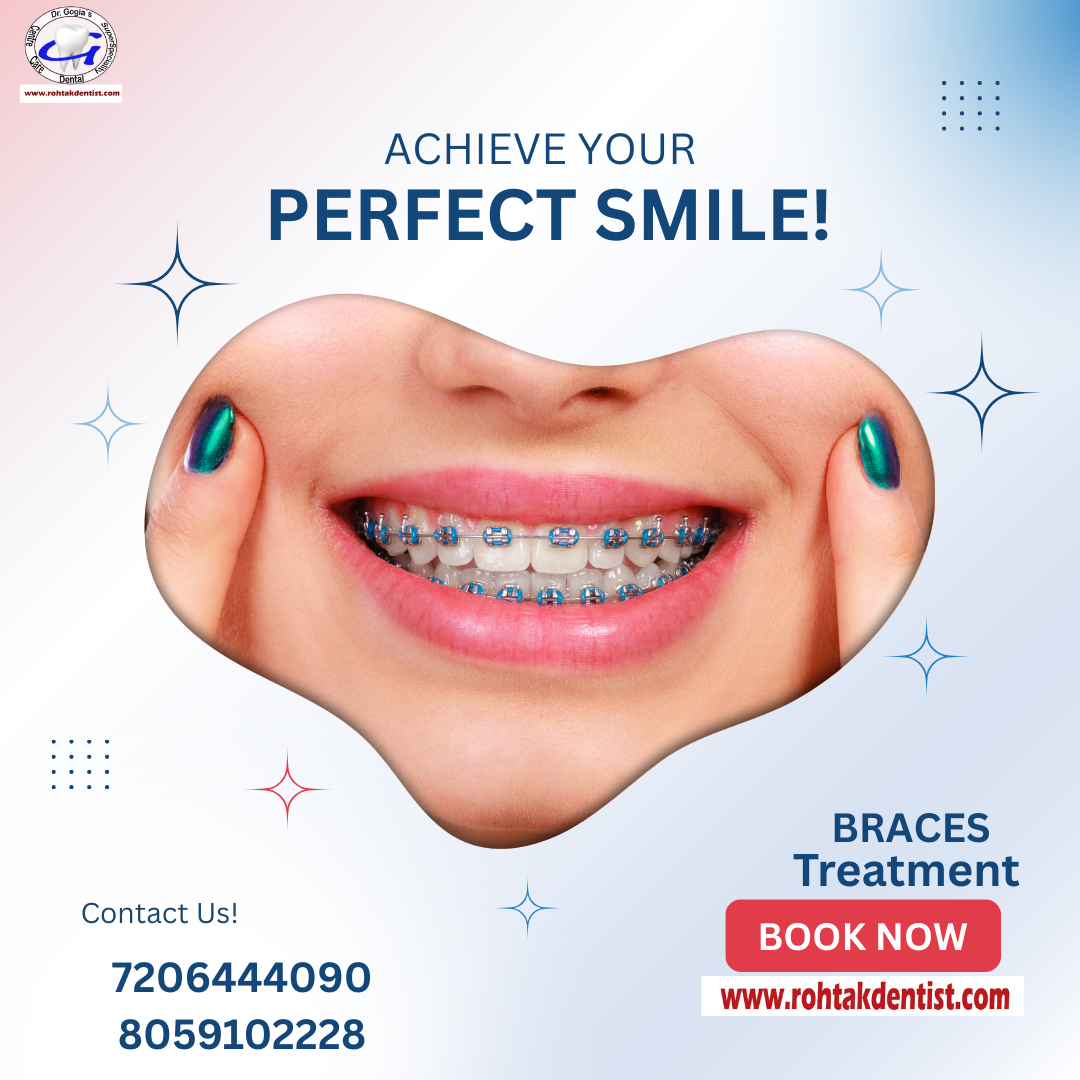 Advanced dental braces treatment for straight teeth and a confident smile at Dr. Gogia’s Super Specialty Dental Care Centre, Rohtak