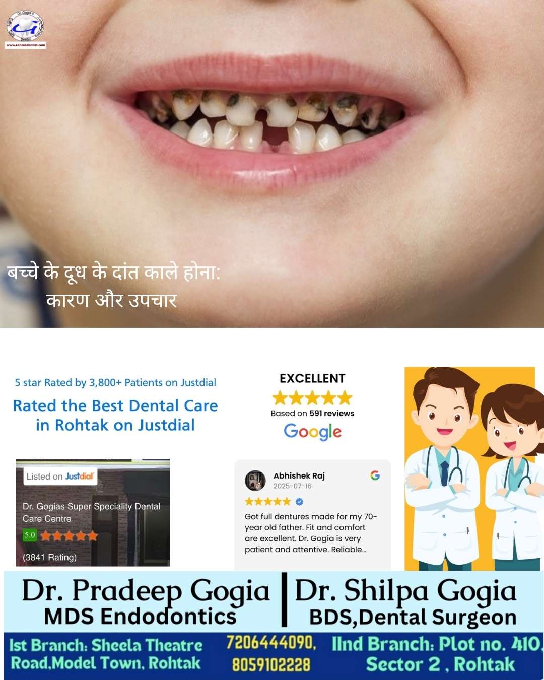 Black baby teeth causes and treatment at Dr. Gogia’s Super Specialty Dental Care Centre Rohtak