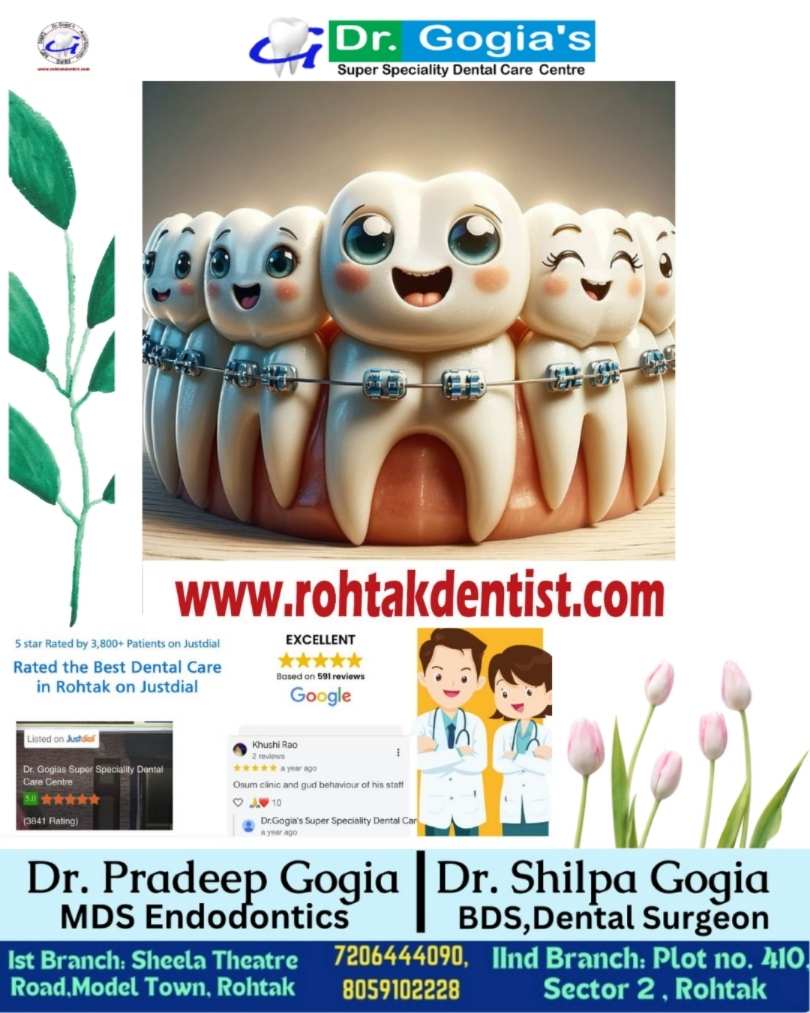 Aligned teeth after dental braces treatment at Dr. Gogia’s Clinic, Rohtak