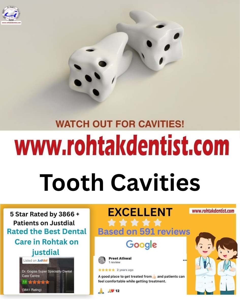 Tooth cavity treatment at Dr. Gogia’s Super Specialty Dental Care Centre in Rohtak for early detection, prevention, and healthy teeth restoration.