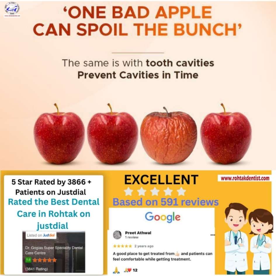 Cavity treatment at Dr. Gogia’s Super Specialty Dental Care Centre, Rohtak for healthy and pain-free teeth.