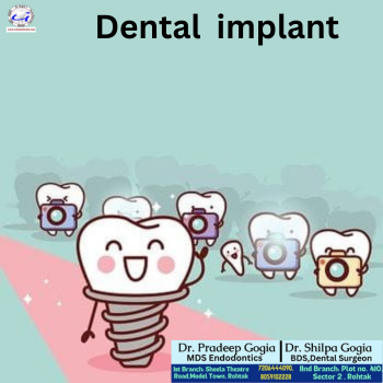Dental Implant at Dr. Gogia's Dental Care Centre, Rohtak