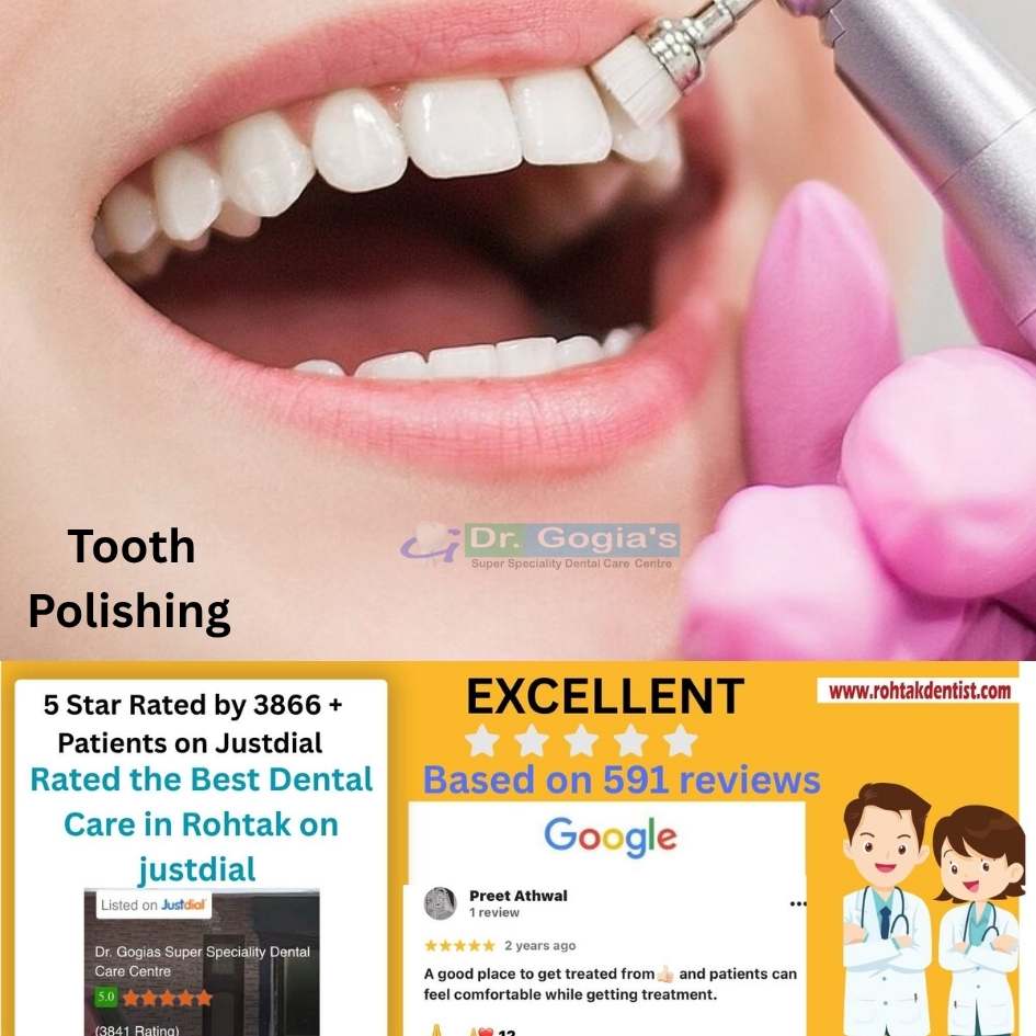 Tooth polishing treatment at Dr. Gogia’s Super Specialty Dental Care Centre Rohtak for bright, stain-free teeth and healthy smile.