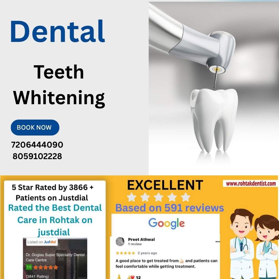 Teeth whitening treatment at Dr. Gogia’s Super Specialty Dental Care Centre, Rohtak for brighter, healthier smile