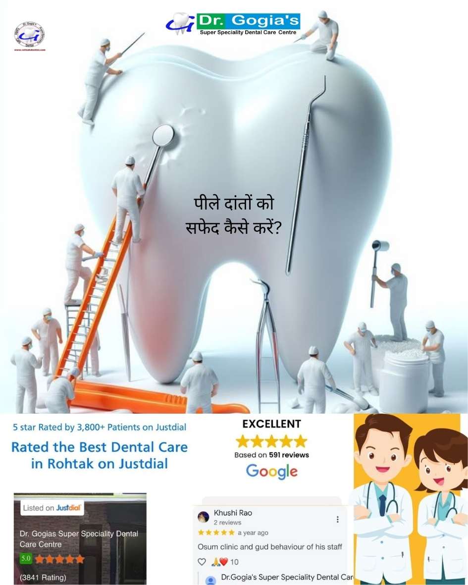 Natural ways to whiten yellow teeth at home – Dr. Gogia’s Super Specialty Dental Care Centre, Rohtak.