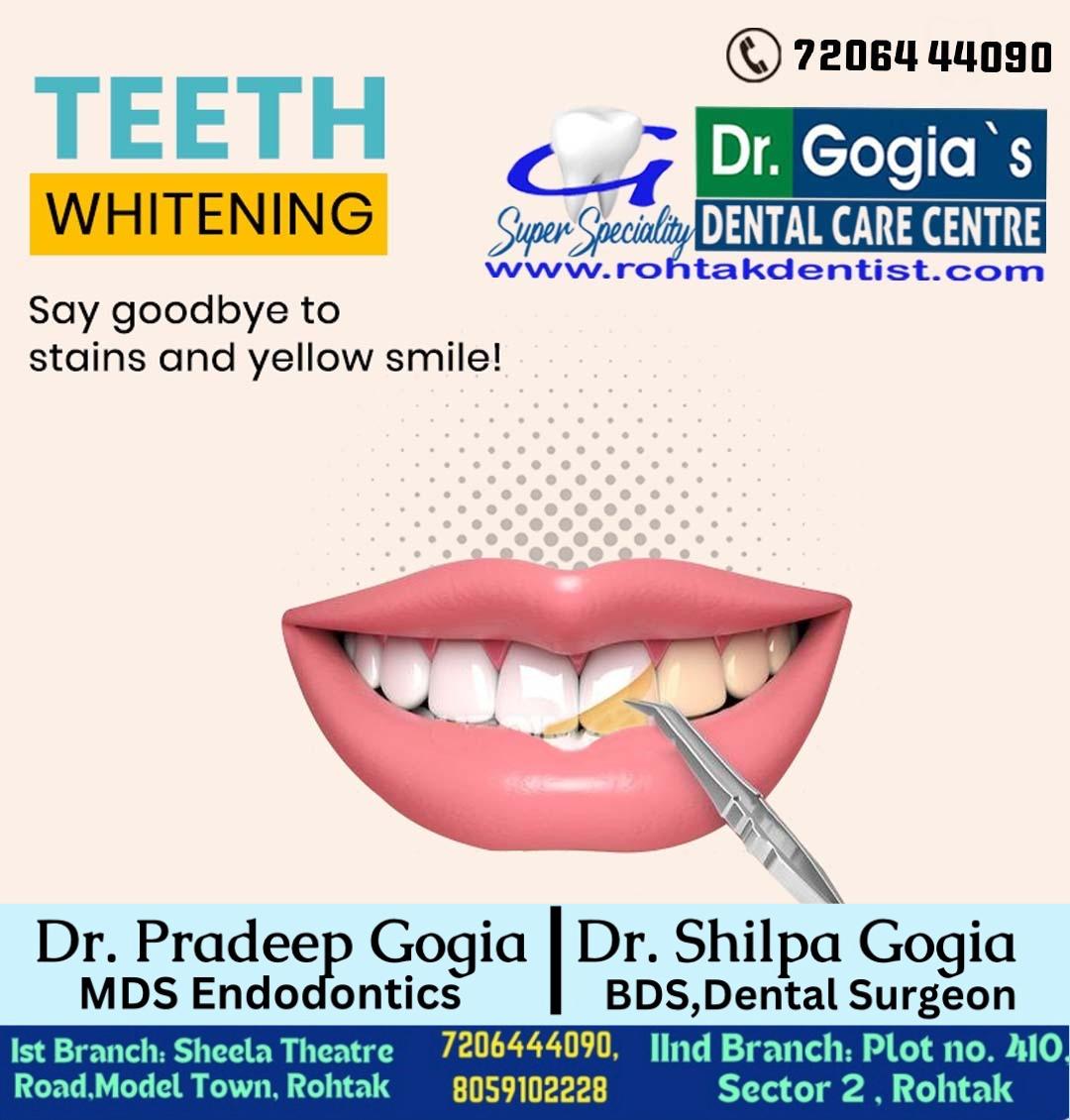 Professional teeth whitening treatment in Rohtak at Dr. Gogia’s Dental Care