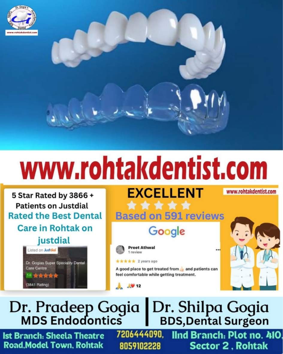 Teeth aligner treatment at Dr. Gogia’s Super Specialty Dental Care Centre, Rohtak for perfect smile alignment and affordable orthodontic care.