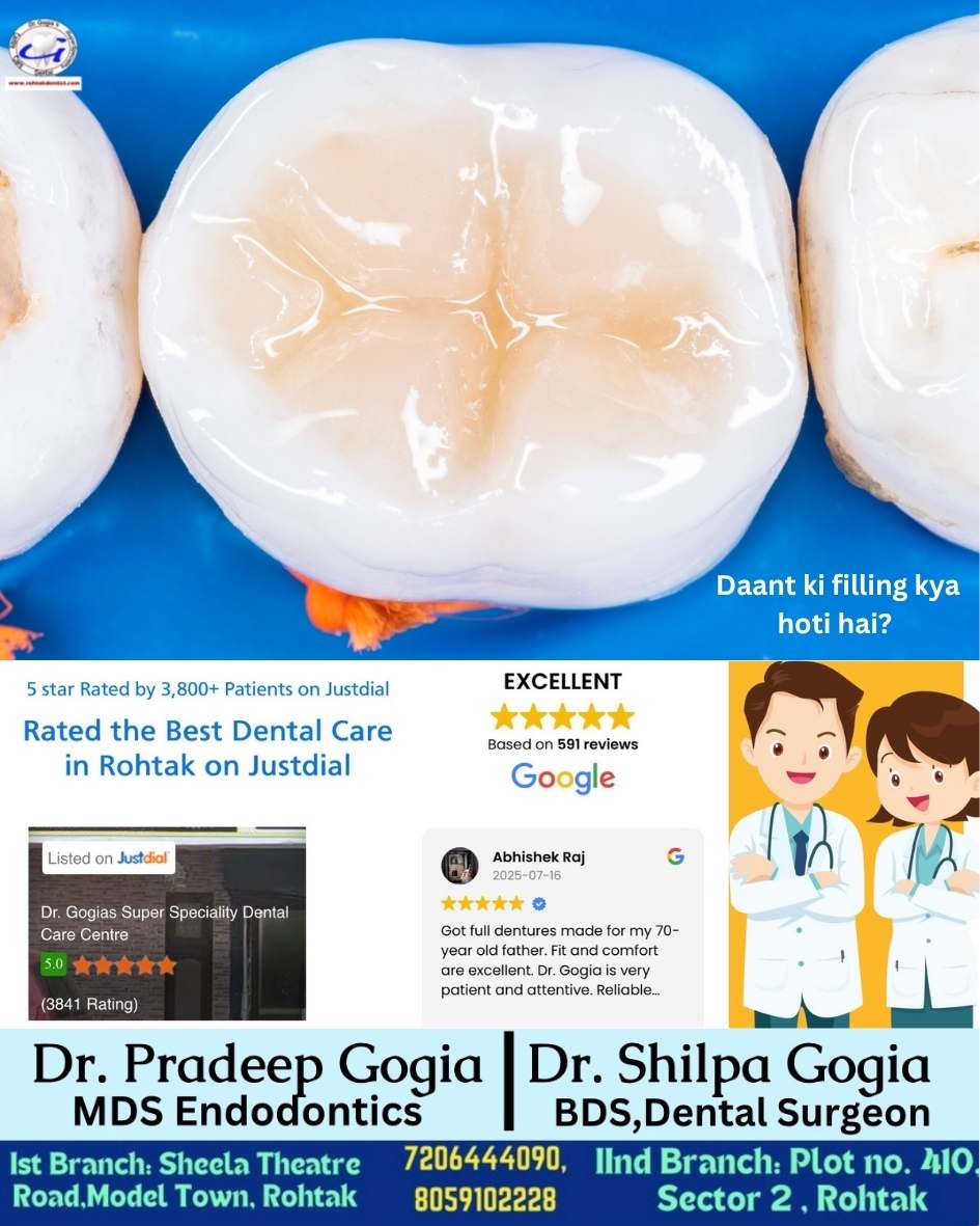 Restore Your Smile with Expert Dental Filling in Rohtak