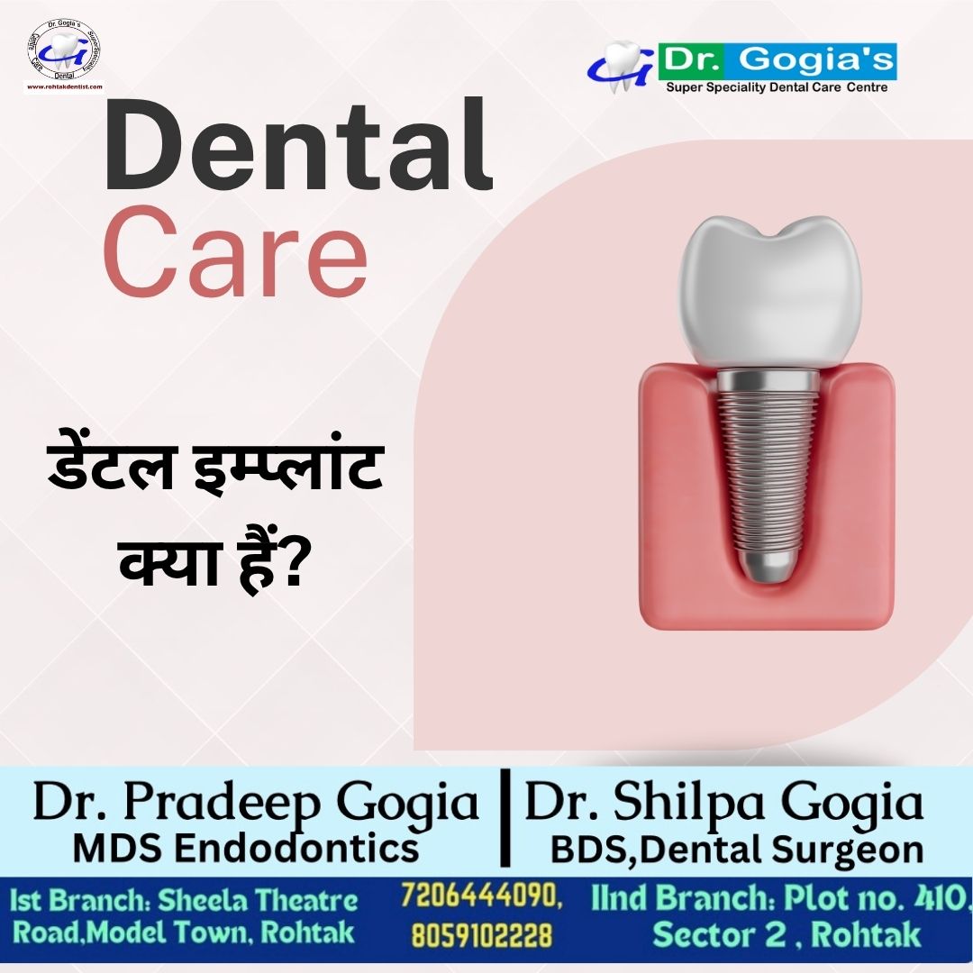 Dental implants treatment in Rohtak – restore missing teeth and achieve a healthy, confident smile at Dr. Gogia’s Super Specialty Dental Care Centre