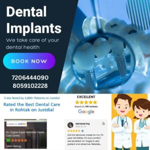 Dental implant procedure and benefits explained by Dr. Gogia’s Super Specialty Dental Care Centre Rohtak